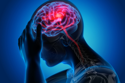 How Do You Treat A TBI Headache?