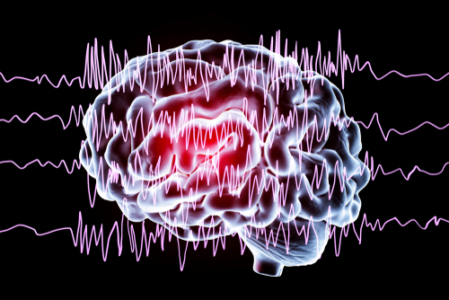 Seizures and Traumatic Brain Injuries
