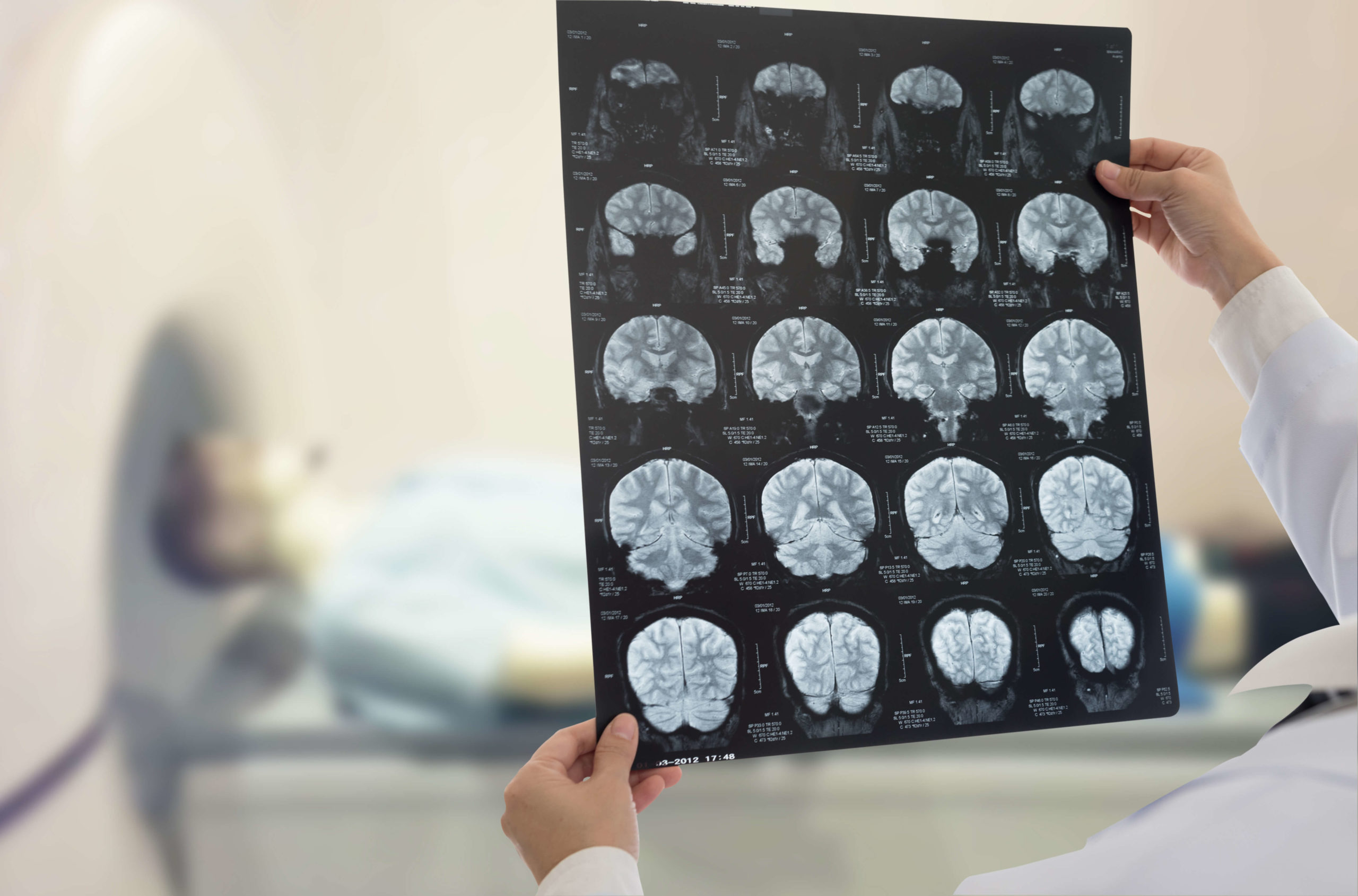 Acquired Brain Injury: Non-Traumatic vs Traumatic – What’s the Difference?