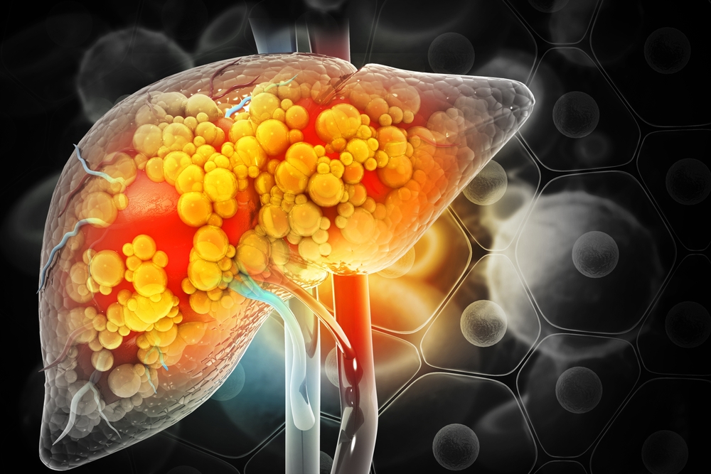 What Are The First Signs Of Liver Damage From Alcohol?